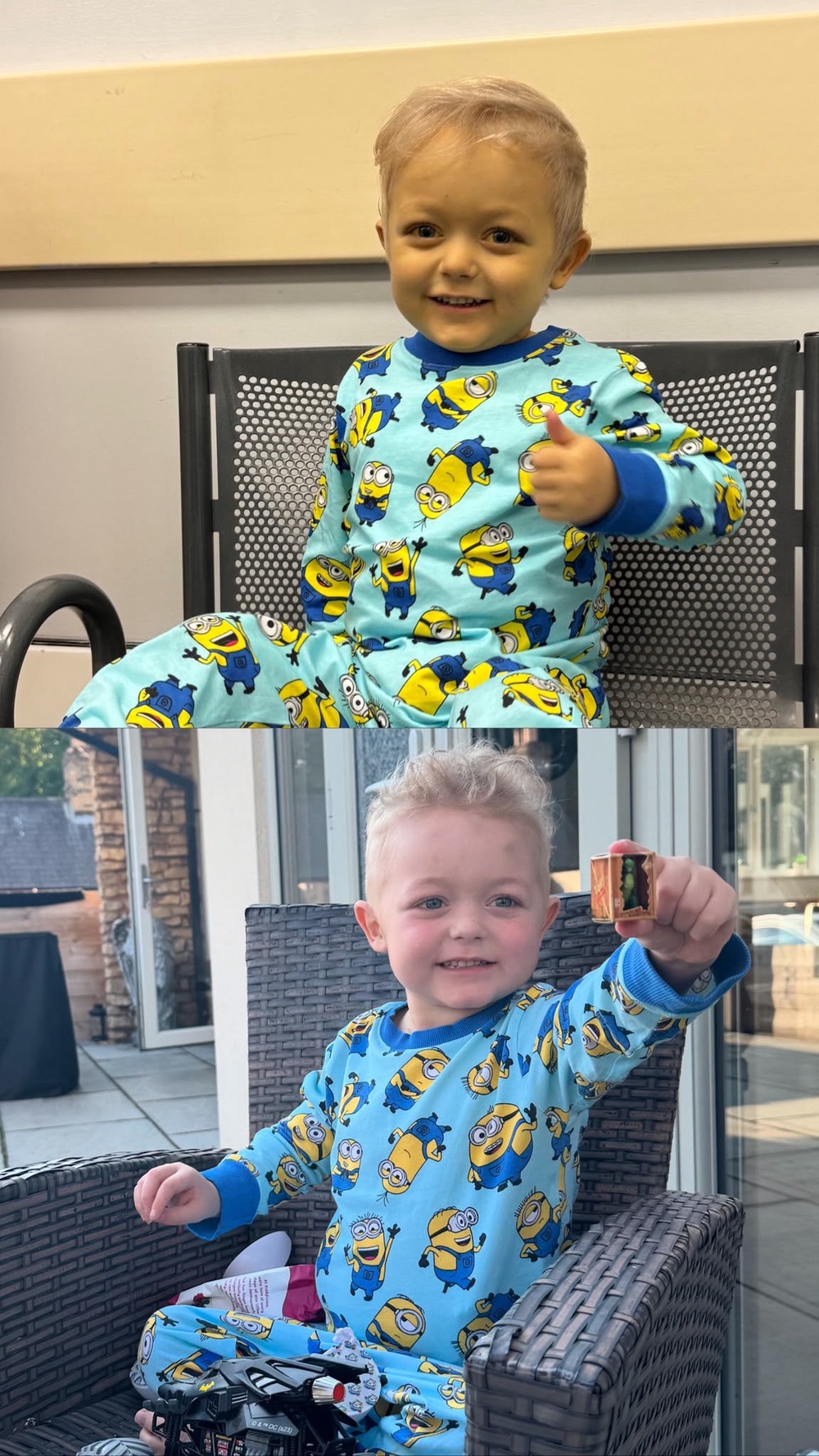 Harry before and after he received a liver and bowel transplant (Family handout)