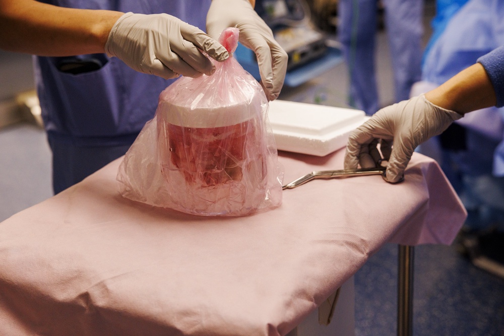 The genetically edited pig kidney allowed Mr Andrews to stay off dialysis for nine months in a world first (PA Media)