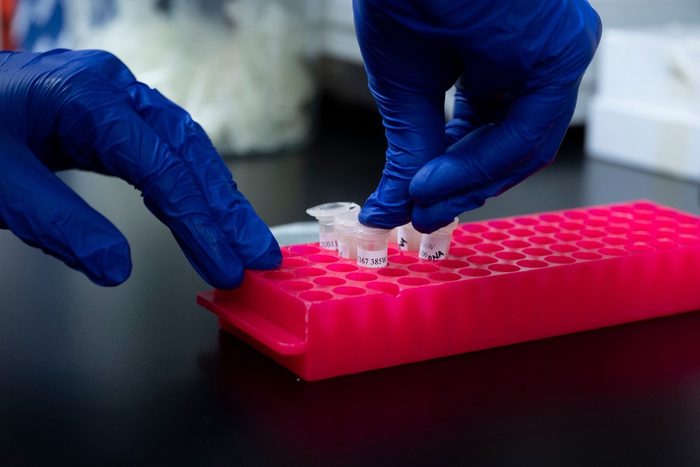 Gene editing study for treating sickle cell disease in rhesus monkey (AFP via Getty Images)
