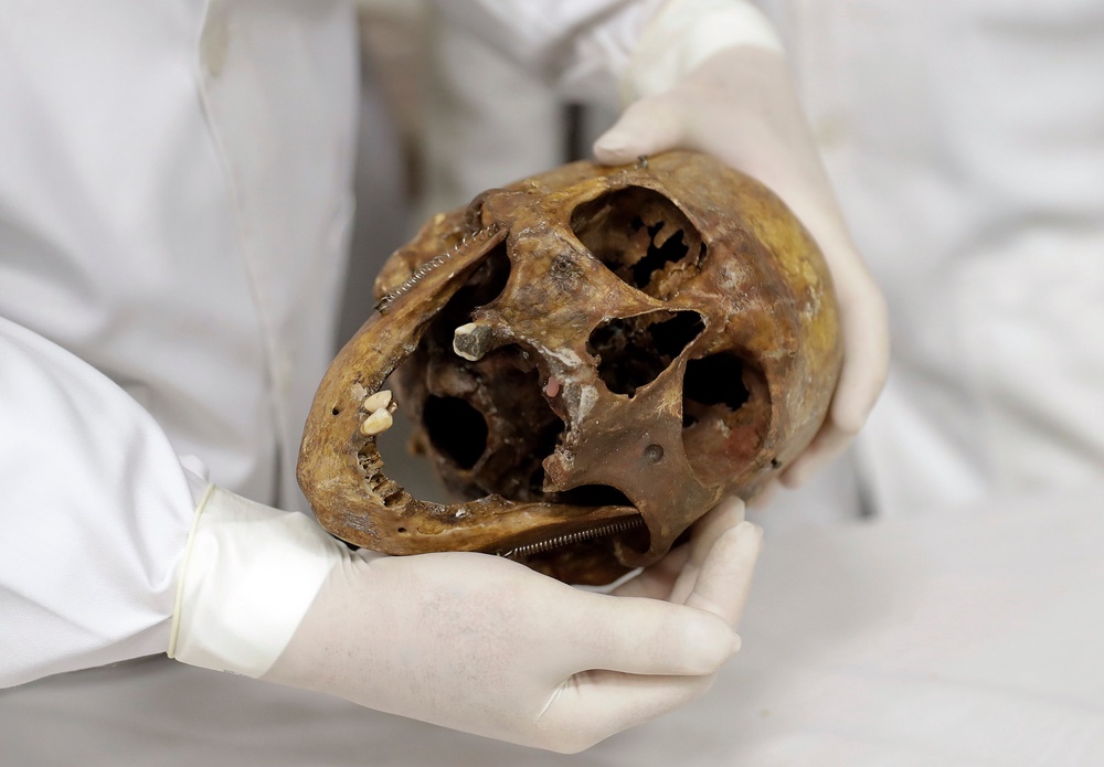 In this Saturday, Dec. 7, 2016 photo, forensic doctor Daniel Munoz shows the skull of Nazi war criminal Josef Mengele, at the school of medicine of Sao Paulo University (Copyright 2017 The Associated Press. All rights reserved.)