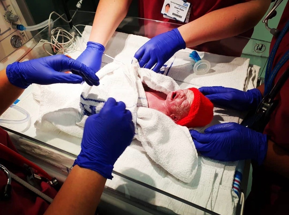 Baby Beatrix was born weighing just 3lb 3oz (Imogen Tinkler)