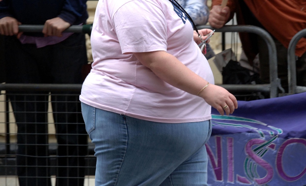 Excess weight can also be a factor in cancer risk (PA) (PA Archive)