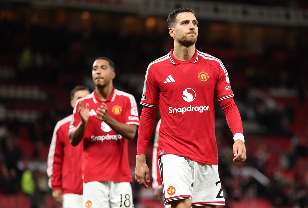 Diogo Dalot of Manchester United reacts after defeat to Brighton (Getty)