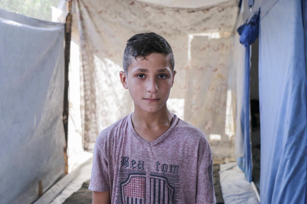 Khaleel, 10, was seriously injured by an explosive remnant of war while playing football near a school in Gaza. He suffered multiple shrapnel injuries to his face, eyes and ear (Save The Children)