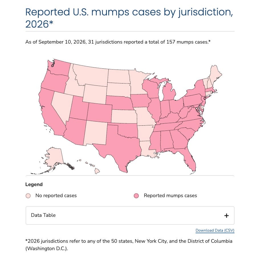 This U.S. Centers for Disease Control and Prevention map shows where mumps cases have been reported nationwide this year, highlighting those states and jurisdictions in dark pink (CDC)