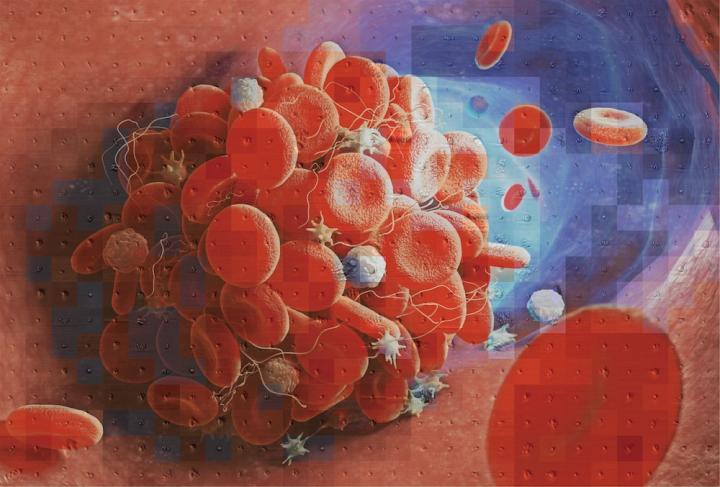 Mosaic of a blood clot (Yuqi Zhou via Eurekalert)