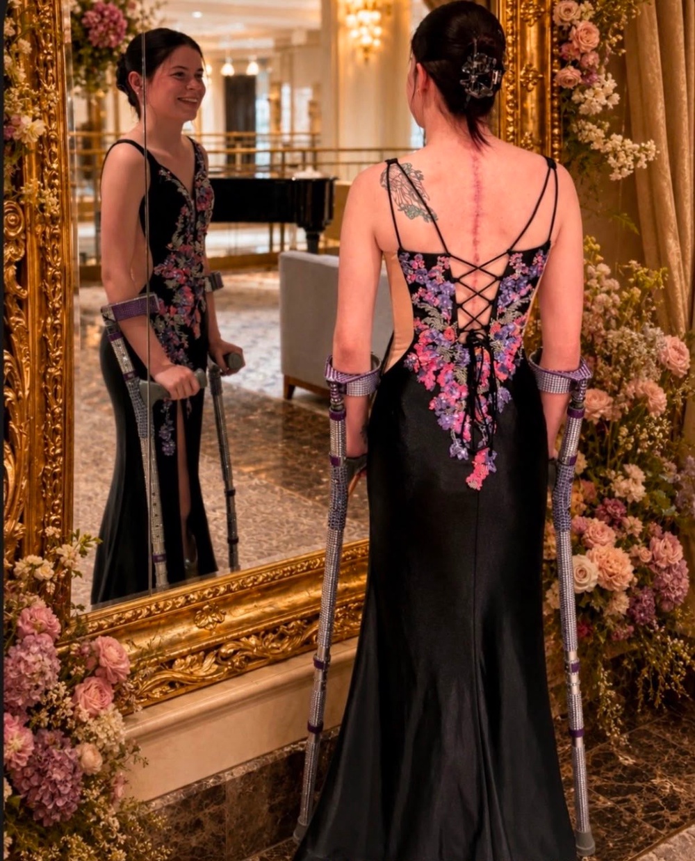 She now feels confident enough to wear backless dresses and tops (Collect/PA Real Life)