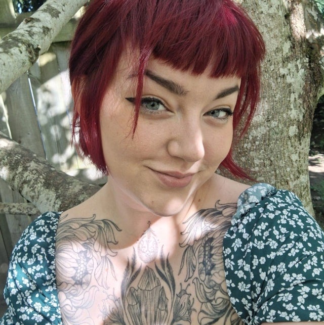 Charlotte McCann, 27, from Huntly in Aberdeenshire, has suffered from endometriosis since she was a teenager (Handout/PA) (Handout)