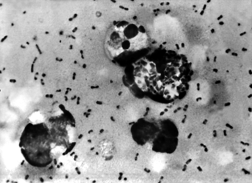 Reports have claimed that the worker died from pneunomic plague, cused by yersinia pestis (Pictured) (Getty)
