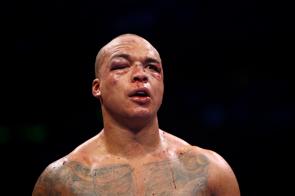 A battered and bruised Fabio Wardley immediately asked his promoter Frank Warren to set up the Daniel Dubois rematch (Getty)
