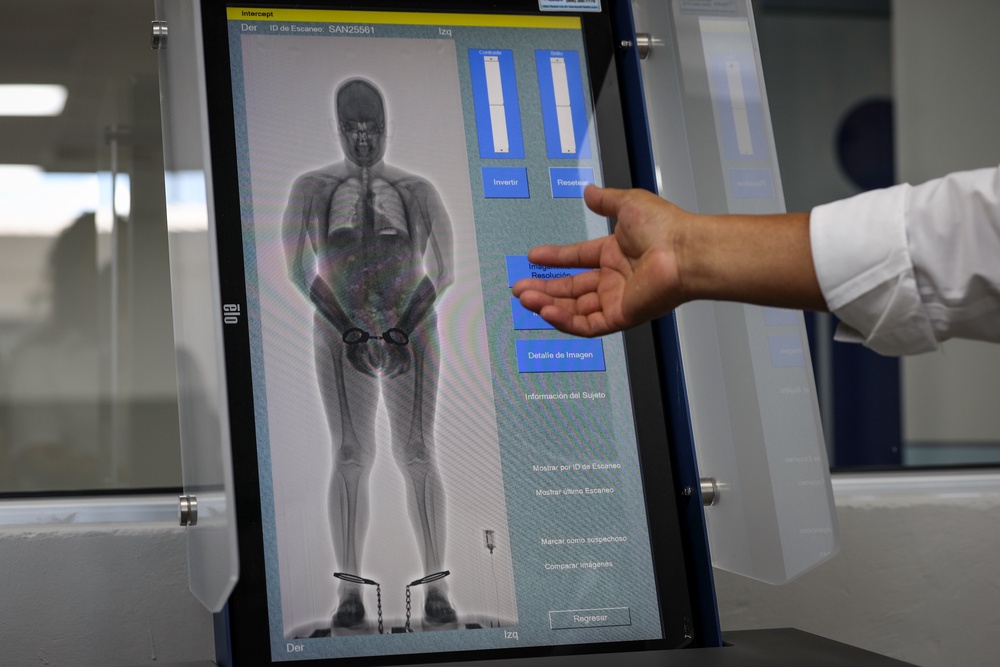 Brown fat was previously believed to vanish after infancy (Getty)