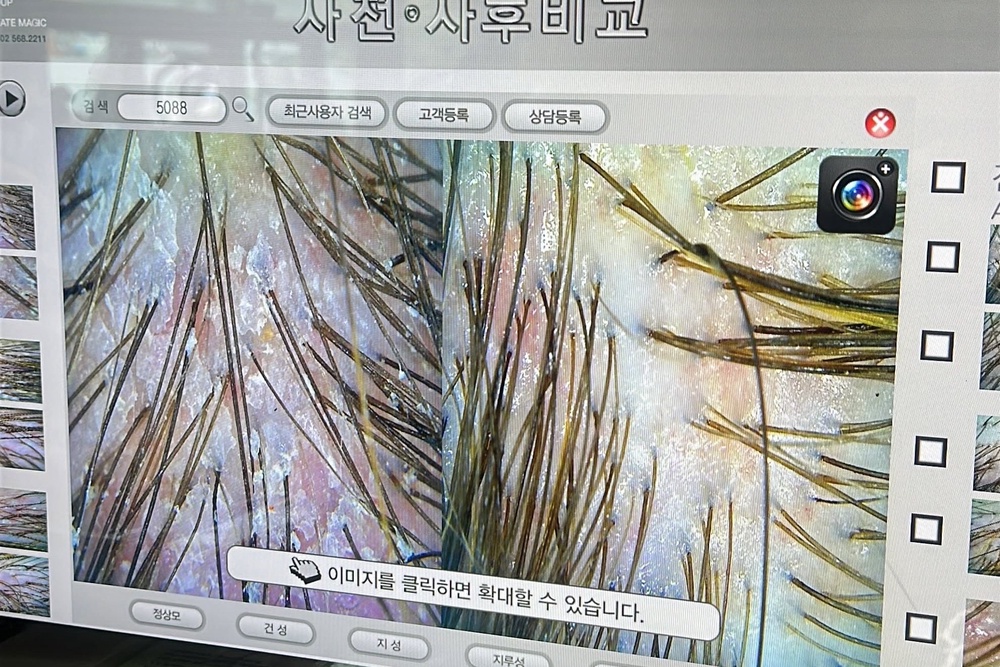 Hayley had her scalp health analysed on a trip to South Korea (Hayley Spencer)