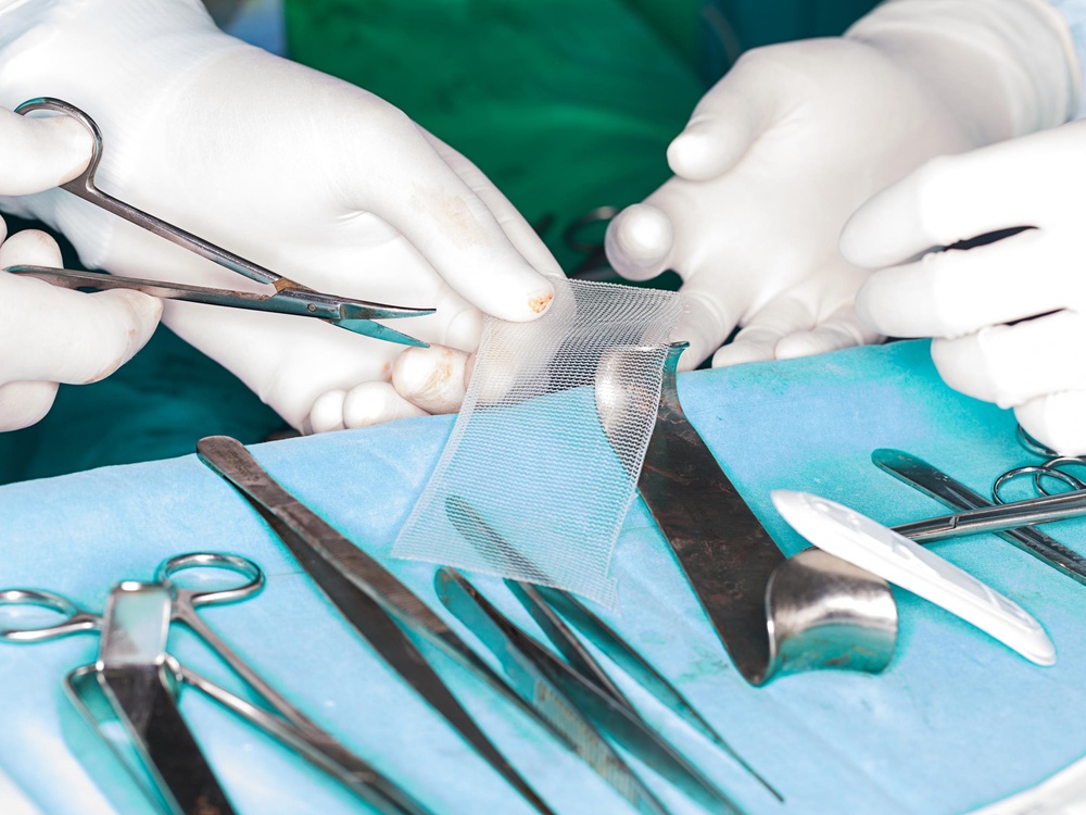 Surgical mesh is used to support weakened tissue and can be implanted to treat pelvic organ prolapse and incontinence (Getty/iStock)