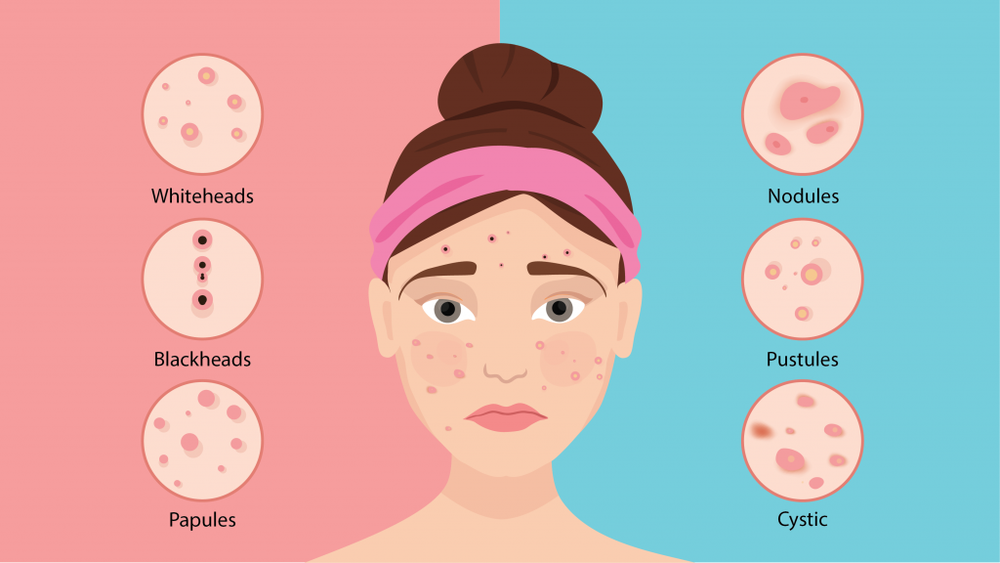 Image from: 5 Body Signals You’re Accidentally Muting