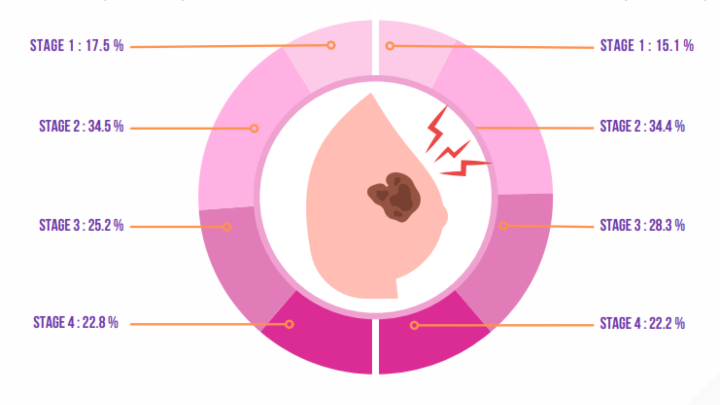 Image from: Breast Lump Doesn’t Have To Hurt To Warrant A Check, Says Surgeon