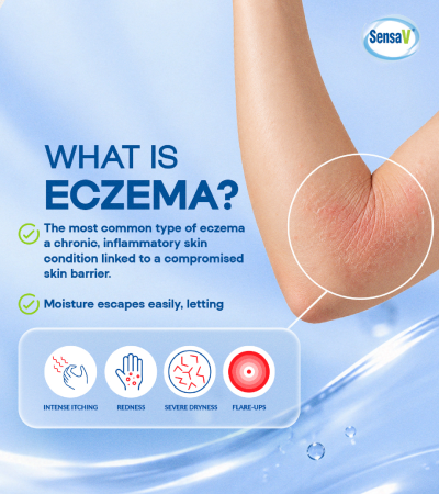 Image from: Eczema Awareness Month: Understanding Eczema the Triggers Behind the Itch