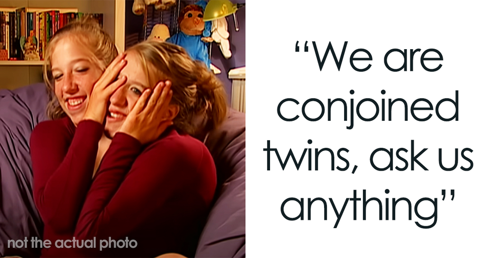 Conjoined Twins Answer The Most Burning Questions