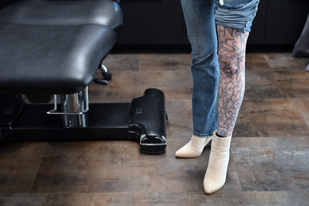 Dutchwoman shows some of the 250 tattoos her abusive partner scrawled all over her leg. — AFP pic