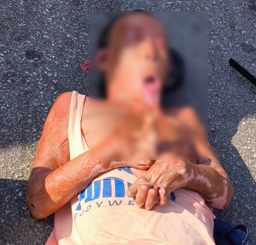Image from: 看了好心酸!大马中年男子烈日下平躺Taman OUG乞讨!网友:在 kepong 见过他!