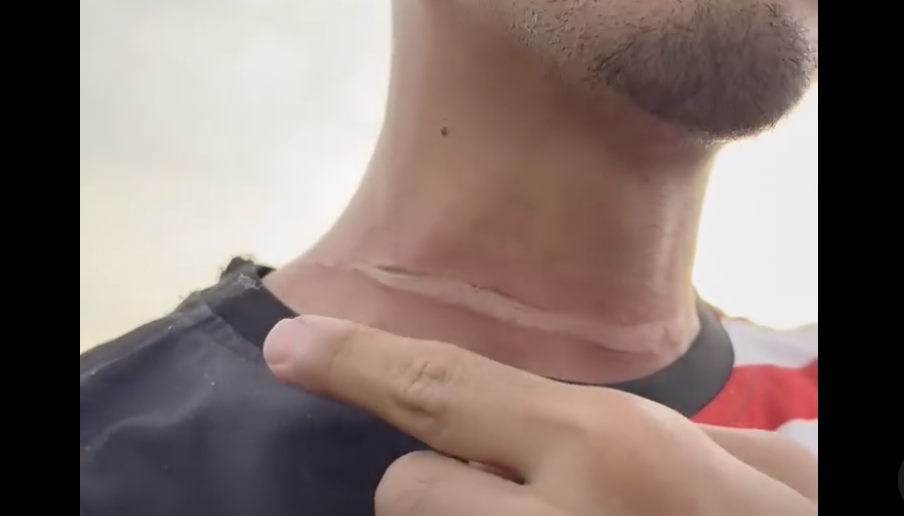 Motorcyclist Nearly Strangled By Kite String DBKL To Crack Down On 