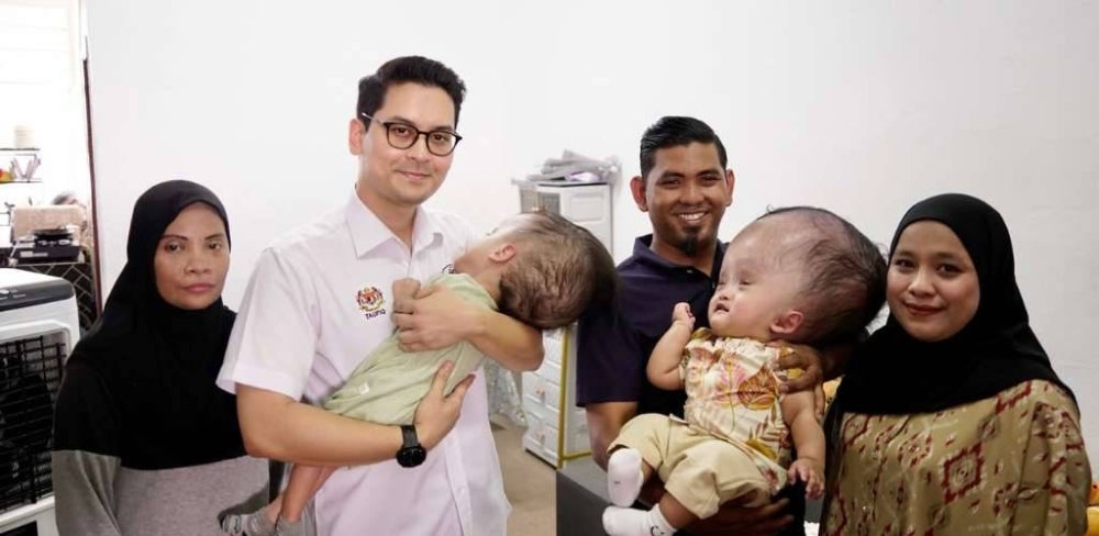 Image from: 'Sebak depan mata…' – Kisah dua beradik hidap hydrocephalus sentuh hati Dr Taufiq Johari, ambil Rayhan & Mateen jadi anak angkat