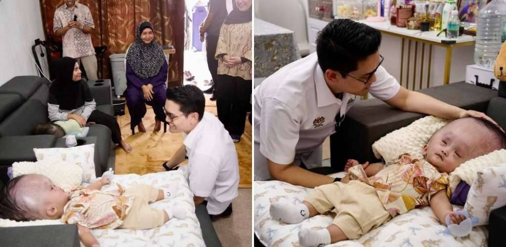 Image from: 'Sebak depan mata…' – Kisah dua beradik hidap hydrocephalus sentuh hati Dr Taufiq Johari, ambil Rayhan & Mateen jadi anak angkat