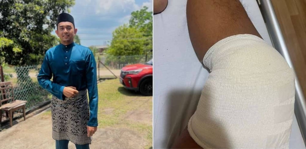 Image from: 'Bomba, doktor pelik aku boleh selamat' - Lelaki kongsi terperangkap 3 jam dalam longkang 12 meter, lutut terbelah siap ada kulit ular!
