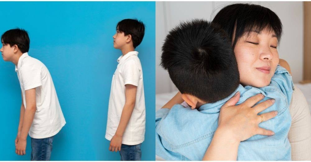 Image from: Bukan sekadar postur, belakang anak senget mungkin tanda skoliosis, Ibu bapa jangan terlepas pandang!