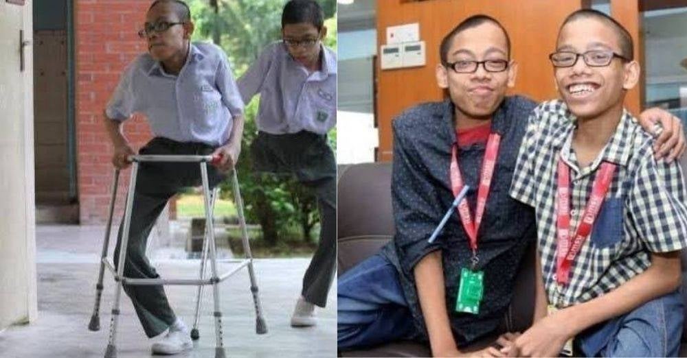 Image from: Kembar Siam dipisahkan tahun 2002 Muhammad Rosli meninggal dunia melawan kanser. 'Adik telah kembali kepada Sang Pencipta'