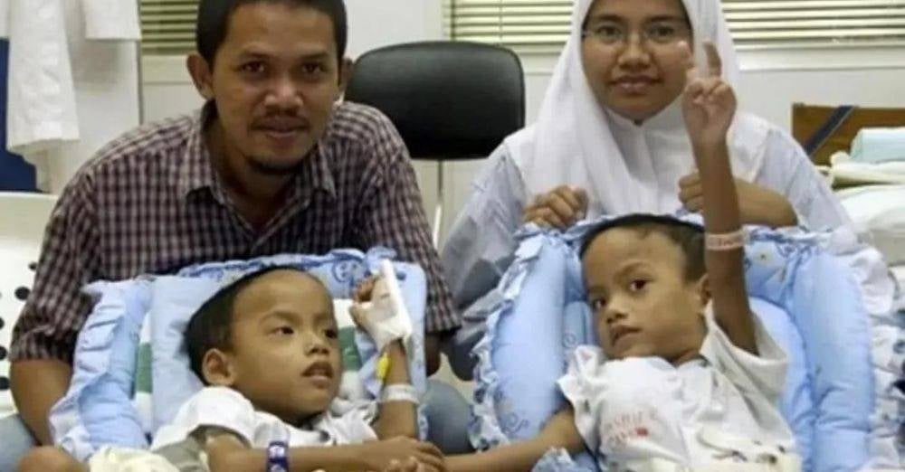 Image from: Kembar Siam dipisahkan tahun 2002 Muhammad Rosli meninggal dunia melawan kanser. 'Adik telah kembali kepada Sang Pencipta'