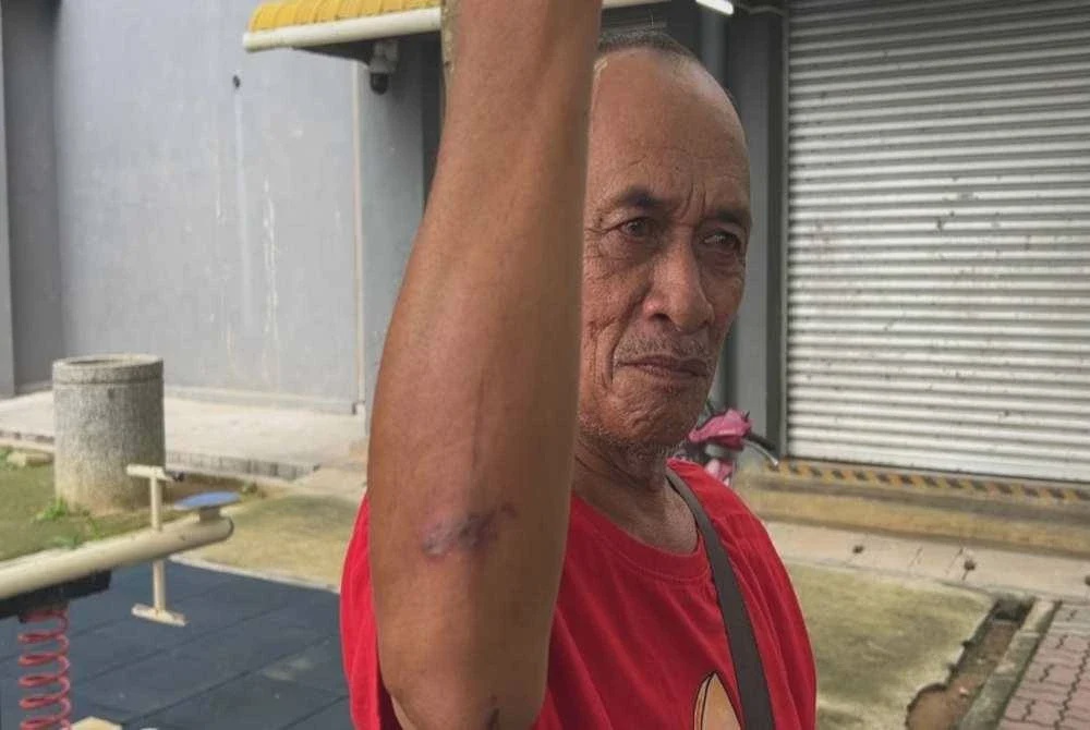 Image from: Muka mengelupas, bayi 4 bulan antara mangsa serangan semut charlie di PPR Hiliran