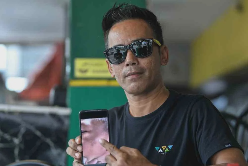 Image from: Budak 9 tahun lebam dakwa ditumbuk, dibuli pelajar senior