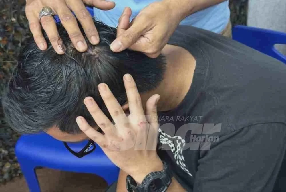 Image from: Bekas banduan rempuh dua Lans Koperal ketika cuba seludup PATI