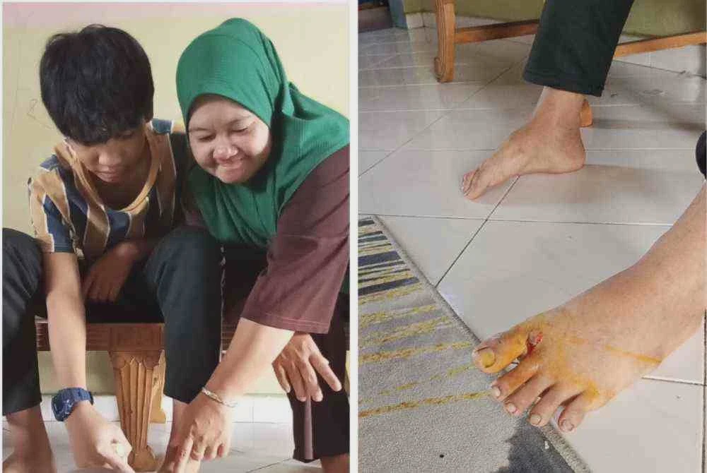 Image from: [VIDEO] Lagi kes kanak-kanak diserang anjing liar: Alif keluar beli ubat, hanya 200 meter dari rumah