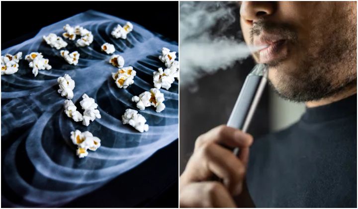 can geek bar vapes cause popcorn lung Geek Bar Pulse X Refill Truth Vapers Should Know main image 1