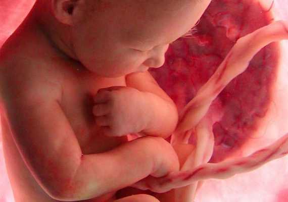 Stillbirth: What, How and Your Rights