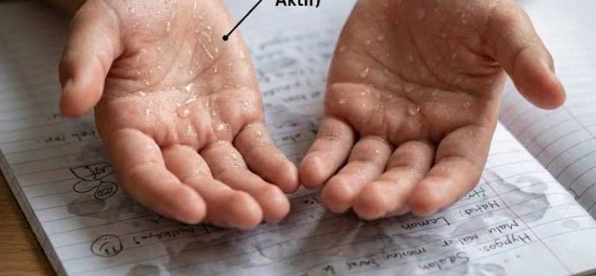 Kenapa anak berpeluh tangan walaupun tak panas