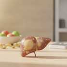 Fatty Liver Disease: The Condition You Probably Never Think About