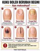 Kuku boleh berubah?