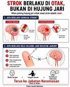 Strok berlaku di otak?