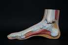 Ankle sprain one kind of injury