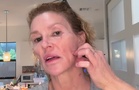 Brandi Glanville reveals facial parasite has 'spread'
