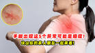 手脚出现这5个异常可能是癌症 ❗🦠快@你的家人朋友一起来看❗