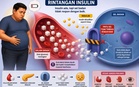 Obesiti & Kerintangan Insulin: "Bom Jangka" Masalah Kesihatan