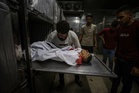 Israel Bunuh 7 Rakyat Palestin, Cedera Lebih 12 Orang dalam Serangan di Seluruh Gaza
