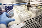 Ugandan woman quarantined in Jaipur after showing Ebola-like symptoms