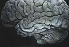 Consciousness: how ‘working memory’ may mysteriously give rise to it