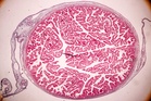 Placenta as property: why every mother deserves the right to choose
