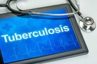 Kangra leads Himachal in TB prevention: 91% coverage achieved