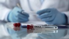 No Ebola case in India, say Health Ministry officials